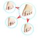 XUEQI Silicone Bunion Corrector Toe Separators - 2 Loop Small Toe Spacer for Bunion Relief and Overlap Toe Alignment - Buy Online on GoSupps.com