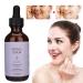 60ml Retinol Facial Serum - Anti-Aging Pore Tightening Wrinkle Removal for Dry & Ripe Skin - International Shipping Available - Buy Online on GoSupps.com