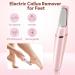 Smooth Pedicure Wand - Electric Foot Callus Remover | Rechargeable Pedicure Tool for Feet Care | Removes Dry Skin & Dead Skin - Ideal Gift (Pink - Buy Online on GoSupps.com
