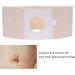 Buy 3 Sizes Ostomy Belt - Colostomy & Stealth Belt for Hernia Support | Medical Abdominal Binder Brace (Unisex - Buy Online on GoSupps.com