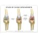 Dog Knee Joint Model Four Stage Knee Arthritis Health Knee and Dog Lesion Joint Model for Veterinary Office Teaching Aids - Buy Online on GoSupps.com