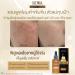 Sewa Dark Spot Solution Black Ginseng Ampoule Concentrate 30ml - Malasma Treatment 1.01 Fl Oz - Buy Online on GoSupps.com