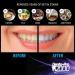 DentaPro2000 Professional Teeth Whitening Strips - Dentist Certified, Enamel Safe, Instant Results - 28 Ct - Buy Online on GoSupps.com
