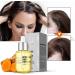 BOKIOESDE Ginger Hair Growth Prevent Hair-Loss Essential Oil Nutrient Solution Fast Growing Scalp Beauty Health Men - Buy Online on GoSupps.com