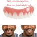 2023 Adjustable Snap-On Dentures: Dental Veneers for Temporary Teeth Restoration - Regain Your Confident Smile! - Buy Online on GoSupps.com