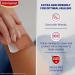 Elastoplast Sensitive Hypoallergenic Plasters - 20pc Medium, Painless Removal, Soft Fabric, Strong Adhesive - Medium Skin Tone - Buy Online on GoSupps.com