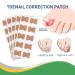 200pcs Ingrown Toenail Corrector Strips - Fitmedify Nail Patches for Toe Nails Fungus - Relief for Ingrown Toenails - Buy Online on GoSupps.com