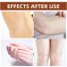 Dark Knees Elbows Knuckles Corrector Cream Skin Cleaning Bleaching Cream for Elbows Knees Armpit Underarm Inner thighs Intimate Areas Dark Spot (120g/4.2oz) - Buy Online on GoSupps.com