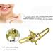 5 PCS Brass Coated Dental Articulator - Adjustable Small Lab Instruments for Dentures | International Shipping - Buy Online on GoSupps.com