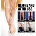 Huile de massage Swellclear pour les jambes huile de massage lymphatique am liore la circulation sanguine rafra chissante et confortable r duit naturellement les gonflements des jambes - Buy Online on GoSupps.com
