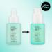 Super Facialist Breakout Buster Serum - Clear Skin Solutions Spot Treatment for Acne with 10% Niacinamide Tea Tree Oil & Prebiotics Vegan Friendly 30ml - Buy Online on GoSupps.com