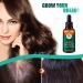 Hair Growth Serum with Ginger Oil - Anti-Hair Loss Thickening & Quick Growth - 30ml for Thinner Hair - Buy Online on GoSupps.com