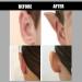 Protruding Ear Correctors - Cosmetic Discreet Protruding Ear Corrector Corrective Ear Patches Ear Care Products for Big Ears Prominent 6pcs - Buy Online on GoSupps.com