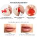 TOPINCN Fish-Shaped Lip Plumper Tool - Portable Silicone Pout Enhancer in Red - Buy Online on GoSupps.com