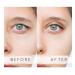 Buy M+L+XL Eyelid Tape Strips | Instant Eyelid Lift for Hooded & Droopy Eyes | Waterproof 24h Stay | International Shipping Available - Buy Online on GoSupps.com
