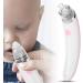 Blackhead Sucker Nasal Aspirator for Newborns & Women - Pink Electric Nose Cleaner for Deep Facial Cleansing and Skin Care - Buy Online on GoSupps.com