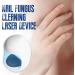 YOXIER Convenient Nail Care Device Non-invasive Fungus Treatment Cleansing Lasers Relief Easy to Operate Blue Light Therapy Infrared White - Buy Online on GoSupps.com