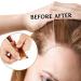 coserori Strong Wig Tape Waterproof Sweat-Proof Traceless Biological Wig Double-Sided Tape for Lace Replacement Hair Extensions - Buy Online on GoSupps.com