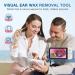 TPARIS Ear Otoscope Camera with 5 Screen - 3.9mm HD Ear Wax Removal Camera - 5MP, 1280x720 Resolution - For Kids, Adults, and Pets - Buy Online on GoSupps.com
