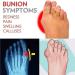 Orthopedic Women's Bunion Correction Sandals - Arch Support, Open Toe, Flat Sole - Buy Online on GoSupps.com
