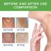 Neck Firming Cream Tighten and Lift Neck Cream Neck Line Remover Neck Tightening and Firming Vitamin C Vitamin E Moisturizing Anti Aging Reduce Neck Fine Lines Improve Roughness - Buy Online on GoSupps.com