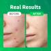 CRAZYSKIN Centella Tica Ampoule 1.7 fl. oz. - Redness Relief for Troubled Skin | Korean-Made Facial Serum - Buy Online on GoSupps.com