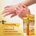 Bee Veno-m Body Cream for Skin Itchiness Smoothing Body Cream for Skin Redness Relieve Skin Itching & Long Lasting Hydration - Buy Online on GoSupps.com