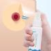 Sting-Free Medical Adhesive Remover Spray - 6 oz for Stomas & Wounds | Alcohol-Free Solution - Buy Online on GoSupps.com