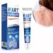 MagiSel Resistant Warts for Hands & Feet Anti-Wart and Anti-Stain Cream Anti-Wart Moisturizing Cream Anti-Corn Foot Descaling Wart Remover for Hands and Feet 20g
