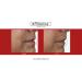 Fillerina 12 Densifying-Filler - Intensive Filler Treatment Grade 3 (2x30ml) - Buy Online on GoSupps.com