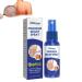 Mandurs South Moon Psoriasis Repair Spray Psoriasis Treatment Spray Herbal Psoriasis Treatment Spray Psoriasis Treatment for Skin Youth Bee Venom Psoriasis Cream for Skin (1pcs)