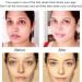 Eye RF Anti Aging Device | Reduce Eye Bags, Puffiness, Dark Circles | Home Radio Frequency Beauty Instrument for Eyes - Buy Online on GoSupps.com
