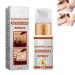 GHEART Acanthoclear Therapy Spray Acanthosis Nigricans Treatment Dark Knuckle Whitening Serum Dark Knuckle Whitening Serum Spray Dark Knees and Elbows Strong Whitening Essence Spray 30ml