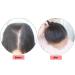 25 cm Real Hair Clip-In Hairpiece for Thinning Hair | Lightweight & Natural Look - Buy Online on GoSupps.com