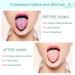 Adult Tongue Scraper Cleaner Set - Fresh Breath Tongue Scraping (3 Pack, Random Color) - Buy Online on GoSupps.com