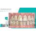 Opalescence Sensitivity Relief Whitening Toothpaste - Intense Whitening & Gentle Care for Sensitive Teeth - Shop Internationally - Buy Online on GoSupps.com