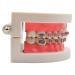 Orthodontic Treatment Model | Standard Teaching Tool for Metal Brackets | Educational Demonstration for Students - Buy Online on GoSupps.com