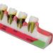 Dental Parodontitis Model - Visualize Stages & Improve Communication Between Dentists and Patients | International Shipping - Buy Online on GoSupps.com