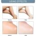 Cr me blanchissante instantan e 10 secondes pour aisselles aisselles correcteur de taches sombres et dissolvant pour genoux coudes parties sensibles (2 pi ces) - Buy Online on GoSupps.com