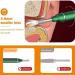 NAUTIG Ear Wax Removal Tool Camera - Safe Non-Detachable Ear Scoop Kit for Earwax Removal - Luminous Ear Picking Device - Buy Online on GoSupps.com