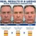 OPENEYES Awaken Peptide Eye Gel Set - Reduces Puffiness, Dark Circles, and Wrinkles (3pcs) - Buy Online on GoSupps.com