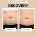 Roe Wellness Stretch Mark Cream for Sensitive Skin | Hydrating Formula for Elasticity & Firmness - Buy Online on GoSupps.com