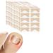 Ingrown Toenail Treatment 100Pcs Breathable Corrector Patch Painless Nail Corrector Ingrown Toenail Strips Ingrown Nail Treatment Correction Stickers Not Easy to Fall Off (Light Brown)