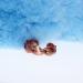 Adjustable Magnetic Copper Ring for Arthritis Relief - Men & Women - Buy Online on GoSupps.com