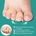 Welnove Gel Toe Separators - Small Toe Pillows & Sleeves for Friction Relief (8 Pack Beige) - International Shipping Available - Buy Online on GoSupps.com