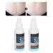 Scar Removal Cream 2pcs - Mild Gel for Old & New Scars, Stretch Marks, Wrinkles - 50ml - Buy Online on GoSupps.com