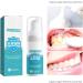2PCS Mouthwash Toothpaste Foam - Calculus Removal, Teeth Whitening & Bad Breath Elimination - Buy Online on GoSupps.com