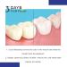 3 Days Teeth Whitening Powder Teeth Whitening Powder for White Teeth | Teeth Whitening | Visible Cleaning Effect | Safe Teeth Whitener - Cosmetic Teeth Cleaning (3) - Buy Online on GoSupps.com