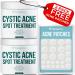 TreeActiv Cystic Acne Spot Treatment | Sulfur 3% & Tea Tree Oil Blemish Remover for Face & Body | Zit, Milia, Severe & Hormonal Acne Treatment for Teens, Adults, Men, & Women | 240+ Treatments, 2-Pack