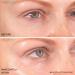 Neck & Eyes Combo Skincare Tool | Under Eye Serum & Neck Line Remover | Wrinkle Filler & Exfoliator for Firm Smooth Skin - Buy Online on GoSupps.com